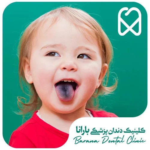 آهن | مکمل ارتباط مصرف مکمل آهن و پوسیدگی دندان