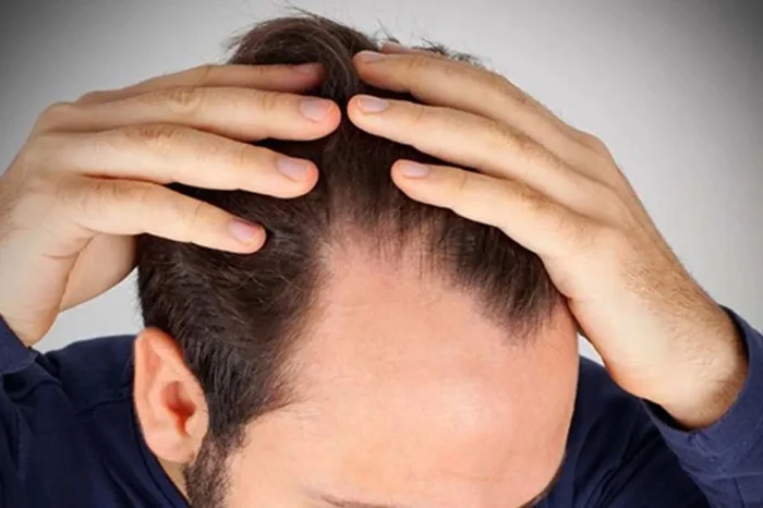 روغن روغن کندش در طب سنتی برای درمان ریزش مو