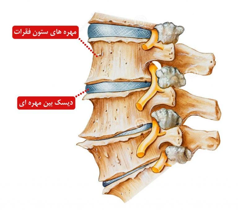 بیماری | ویتامین بهترین مولتی ویتامین دیسک کمر + 7 قرص تخصصی