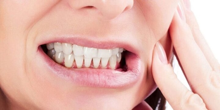 دندان چرا دندانها زود به زود پوسیده میشوند؟