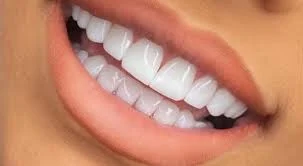 هزینه و قیمت کامپوزیت دندان در کلینیک اسمایل هوم کلینیک