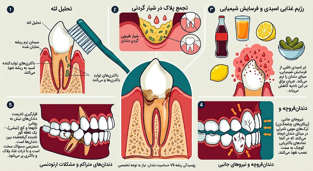 علت پوسیدگی دندان نیش